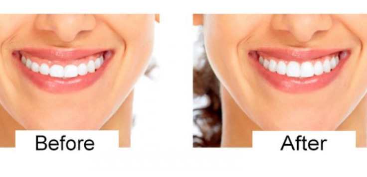 Smile correction Navi Mumbai